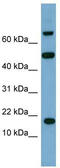 TSC22 Domain Family Member 1 antibody, TA343576, Origene, Western Blot image 