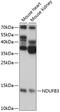 NADH:Ubiquinone Oxidoreductase Subunit B3 antibody, 15-512, ProSci, Western Blot image 