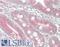 Teck antibody, LS-B13337, Lifespan Biosciences, Immunohistochemistry paraffin image 