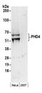 Prolyl 4-Hydroxylase, Transmembrane antibody, NB100-295, Novus Biologicals, Western Blot image 