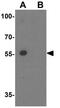 Protein Inhibitor Of Activated STAT 4 antibody, GTX31802, GeneTex, Western Blot image 