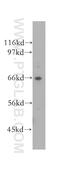 Vacuolar Protein Sorting 45 Homolog antibody, 12616-1-AP, Proteintech Group, Western Blot image 