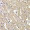 Mannose Phosphate Isomerase antibody, GTX64661, GeneTex, Immunohistochemistry paraffin image 