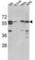 Serine Palmitoyltransferase Long Chain Base Subunit 1 antibody, abx031622, Abbexa, Western Blot image 
