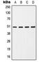 Cholinergic Receptor Nicotinic Alpha 7 Subunit antibody, MBS821295, MyBioSource, Western Blot image 