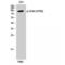 CD44 antibody, LS-C380967, Lifespan Biosciences, Western Blot image 
