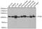 Glycogen Phosphorylase B antibody, GTX64469, GeneTex, Western Blot image 