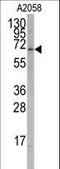 RAR Related Orphan Receptor A antibody, LS-B8962, Lifespan Biosciences, Western Blot image 