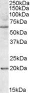 BCL2 Associated Athanogene 4 antibody, STJ71776, St John