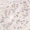 DEAD-Box Helicase 17 antibody, NB200-352, Novus Biologicals, Immunohistochemistry frozen image 