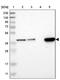 Solute Carrier Family 35 Member E1 antibody, PA5-53447, Invitrogen Antibodies, Western Blot image 