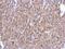 Enolase 1 antibody, GTX113179, GeneTex, Immunohistochemistry paraffin image 