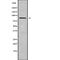 ADAM Metallopeptidase Domain 28 antibody, abx147980, Abbexa, Western Blot image 