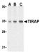 TIR Domain Containing Adaptor Protein antibody, SP2072P, Origene, Western Blot image 