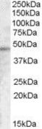 Transmembrane Serine Protease 3 antibody, GTX88931, GeneTex, Western Blot image 