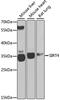 Sirtuin 4 antibody, A7585, ABclonal Technology, Western Blot image 