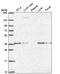 ETS Variant 1 antibody, PA5-67447, Invitrogen Antibodies, Western Blot image 