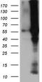 Bone Morphogenetic Protein 6 antibody, LS-C796297, Lifespan Biosciences, Western Blot image 