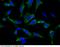 CD22 Molecule antibody, 11958-R340, Sino Biological, Immunohistochemistry frozen image 