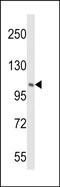 Phosphatidylinositol 4-Kinase Beta antibody, PA5-49603, Invitrogen Antibodies, Western Blot image 