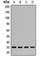 Caseinolytic Mitochondrial Matrix Peptidase Proteolytic Subunit antibody, LS-C667989, Lifespan Biosciences, Western Blot image 