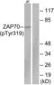 Zeta Chain Of T Cell Receptor Associated Protein Kinase 70 antibody, LS-C117510, Lifespan Biosciences, Western Blot image 