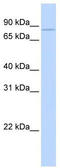 Cytoplasmic Polyadenylation Element Binding Protein 3 antibody, TA334562, Origene, Western Blot image 