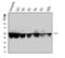 Keratin 8 antibody, M01421-3, Boster Biological Technology, Western Blot image 