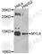 Myosin light polypeptide 6 antibody, A8557, ABclonal Technology, Western Blot image 