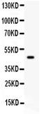 Serpin Family B Member 2 antibody, PB9355, Boster Biological Technology, Western Blot image 