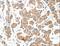 AE Binding Protein 2 antibody, LS-C404462, Lifespan Biosciences, Immunohistochemistry paraffin image 