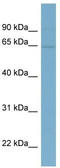 EYA Transcriptional Coactivator And Phosphatase 1 antibody, TA345587, Origene, Western Blot image 