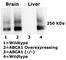 ATP Binding Cassette Subfamily A Member 1 antibody, ab66217, Abcam, Western Blot image 