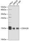 Cyclin-dependent kinase 4 inhibitor B antibody, 19-792, ProSci, Western Blot image 