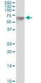 VPS33A Core Subunit Of CORVET And HOPS Complexes antibody, H00065082-B01P, Novus Biologicals, Western Blot image 