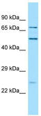 Secretory Carrier Membrane Protein 4 antibody, TA334372, Origene, Western Blot image 