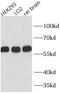 Prolyl 4-Hydroxylase Subunit Beta antibody, FNab09833, FineTest, Western Blot image 