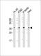 Serine Protease 21 antibody, M09288, Boster Biological Technology, Western Blot image 