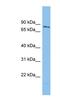 WD Repeat Domain 49 antibody, NBP1-70746, Novus Biologicals, Western Blot image 