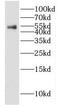 Gamma-Aminobutyric Acid Type A Receptor Alpha1 Subunit antibody, FNab03283, FineTest, Western Blot image 