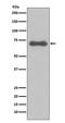 NUMB Endocytic Adaptor Protein antibody, M01206, Boster Biological Technology, Western Blot image 