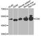 C-Terminal Src Kinase antibody, A0735, ABclonal Technology, Western Blot image 