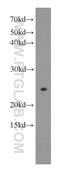 N-6 Adenine-Specific DNA Methyltransferase 1 antibody, 16211-1-AP, Proteintech Group, Western Blot image 