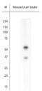 Aristaless Related Homeobox antibody, NBP2-80506, Novus Biologicals, Western Blot image 