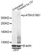 ATM Serine/Threonine Kinase antibody, MBS125807, MyBioSource, Western Blot image 