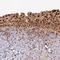 Ribosomal RNA Processing 8 antibody, PA5-58412, Invitrogen Antibodies, Immunohistochemistry paraffin image 