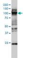 General Transcription Factor IIIC Subunit 2 antibody, H00002976-M01, Novus Biologicals, Western Blot image 