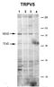 CAT2 antibody, orb330584, Biorbyt, Western Blot image 