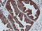 Adipocyte Plasma Membrane Associated Protein antibody, TA504220, Origene, Immunohistochemistry frozen image 