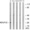 NADH:Ubiquinone Oxidoreductase Core Subunit V2 antibody, A05801, Boster Biological Technology, Western Blot image 